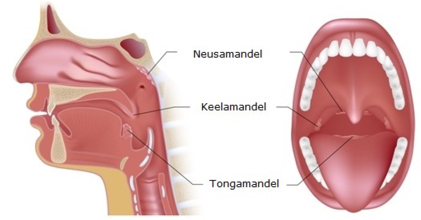 Grafische weergave van de keelamandelen , de neusamandel en de tongamandel.