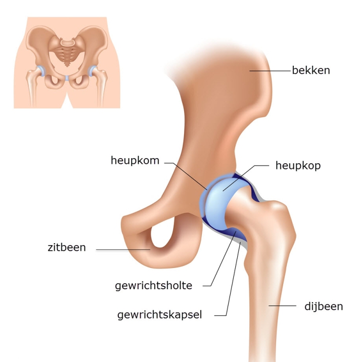 Grafische weergave van het heupgewricht