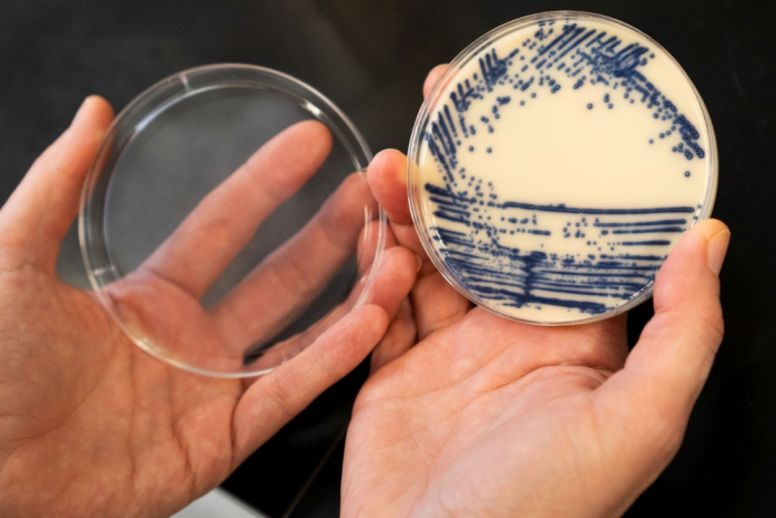 Een staal van de resistente VRE-bacterie.