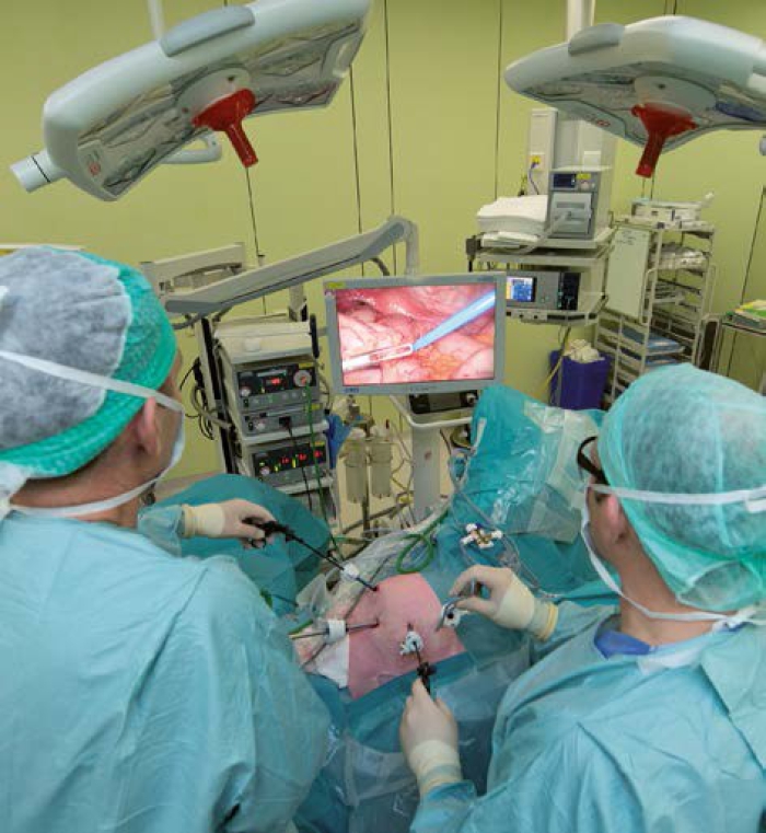 Foto:  Steeds meer operaties kunnen met een kijkoperatie worden gedaan. Bijvoorbeeld een operatie aan de lever, wat tot voor enkele jaren geleden nog niet kon. Dat komt vooral door de beter ontwikkelde apparatuur. 