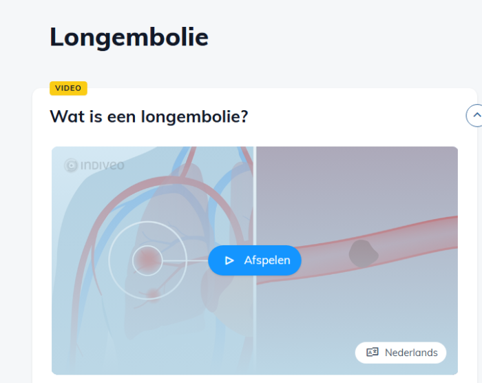 Op deze afbeelding ziet u een voorbeeld van de Divi Longembolie. 