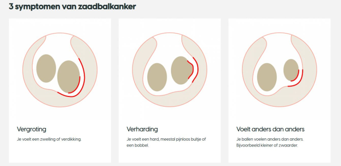 Afbeelding met 3 symptomen van zaadbalkanker: vergroting, verharding of anders voelende ballen