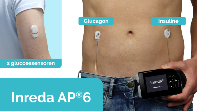 Prototype Inreda AP6. De kunstalvleesklier zit met twee slangetjes verbonden aan de buik van de patiënt. ©Inreda Diabetic