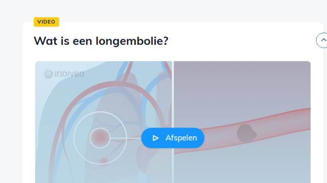 Op deze afbeelding ziet u een voorbeeld van de Divi Longembolie. 